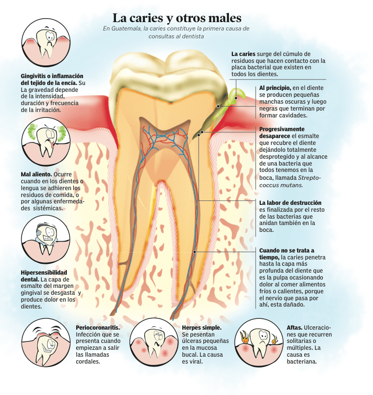 Las caries y otros males